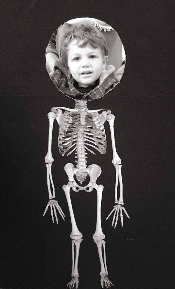 VSF Xray